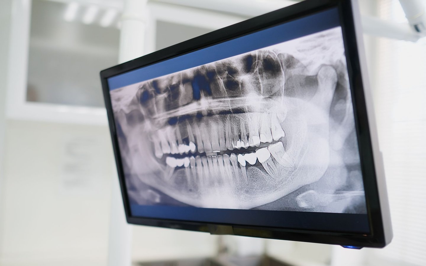 Bilan radiographique