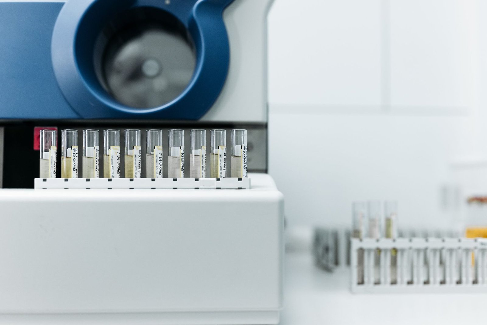 Analyse des prélèvements en laboratoire
